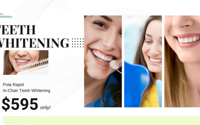 In Chair Whitening At Happy Dentistry