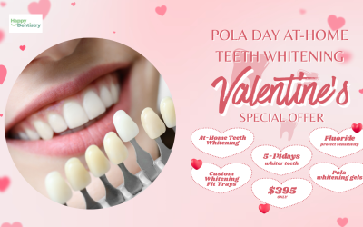 Valentine’s Day Offer- At Home Teeth Whitening