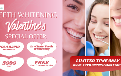 Valentine’s Day Teeth Whitening Offer
